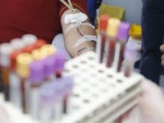 Egpa, l’esperto: “Diagnosi difficile ma con anti Il-5 ottimi risultati”