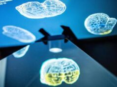 Glioma, tumore cresce con attività cervello: speranza da nuovo studio