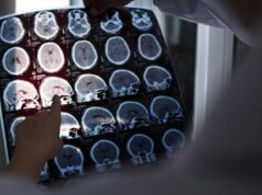 L’Alzheimer si eredita? Più rischi se lo ha avuto la mamma: lo studio