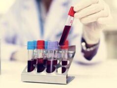 Nuovo tipo di diabete giovanile scoperto in Africa, la conferma che cambia la storia in un maxi studio