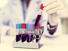 Parkinson, un test del sangue per scoprirlo 7 anni prima dei sintomi: la ricerca