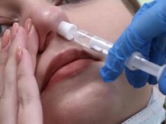 Shock anafilattico, via libera Ema a primo spray nasale di adrenalina