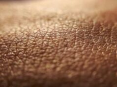 Sidemast: “Presto al via i corsi di formazione in dermatologia etnica”