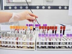 Uap: “Governo argini fondi Regioni a farmacie per attività pre-diagnostica”