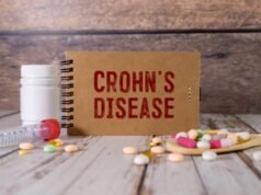 Malattia di Crohn, campagna ‘Crohnviviamo’ fa chiarezza su alimentazione