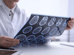 Sclerosi multipla e maternitĂ , neurologa Marfia: “Personalizzare percorso”