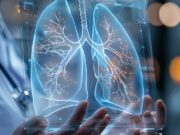 Cancro aggressivo al polmone, con mix di farmaci biologici raddoppia efficacia senza chemio