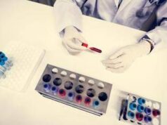 Cancro alla vescica, recidiva ridotta del 32% con immunoterapia durvalumab: lo studio