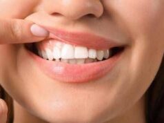 Disturbi gengivali per 60% italiani, esperti: “Prevenzione un investimento”