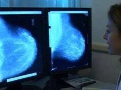 Donne operate per tumore al seno, 70% paga cure e 30% teme per il lavoro