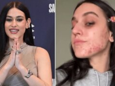 Gaia senza filtri, mostra l’acne sul viso: “Ho pensato di nascondermi, voglio normalizzare”