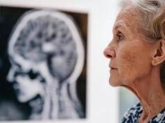 Giornata salute donne, Sin ‘prendetevi cura anche della salute neurologica’