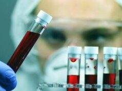 Alzheimer, Sin: “Test del sangue svolta epocale per diagnosi tempestive e cure mirate”