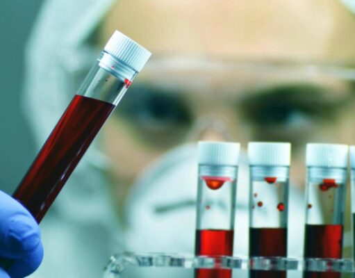 Emofilia, in Italia nuova soluzione sottocute giornaliera per pazienti con inibitori