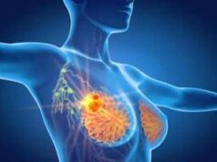 Tumore al seno triplo negativo, speranze da anticorpo farmaco-coniugato