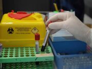 Tumori, nuovo test del sangue ‘low cost’ promette di scoprire diversi tipi di cancro