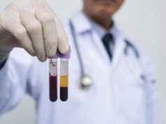 Farmaceutica, Gardini (GenomeUp): “Ai per programmare terapie con plasmaderivati”