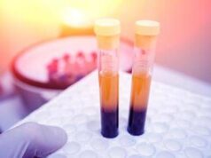Farmaci, Sava (Sif Magazine): “In plasmaderivati attenzione particolare a sicurezza”