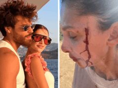 Can Yaman, la fidanzata Sara Bluma denuncia le violenze dell’ex. L’attore: “Ti amo”