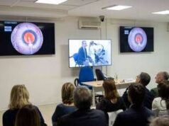 Chirurgia della cataratta, a Tor Vergata formazione con simulatore innovativo Eyesi