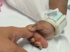 Gemelle siamesi separate al Gaslini di Genova: “Estubate, respirano da sole”