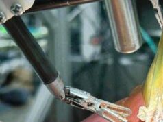 Il ‘dottor robot’ opera da solo, primo intervento senza aiuto umano