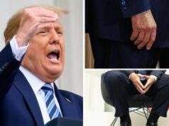 Trump e le gambe gonfie, cos’è l’insufficienza venosa cronica