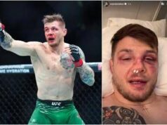 Vettori, ritorno amaro. Perde con Allen e mostra naso rotto e lividi in faccia