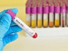 West Nile, quarta vittima in Campania: muore un 73enne