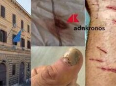 “Picchiato e sequestrato per due giorni da altri detenuti a Regina Coeli”, la denuncia choc