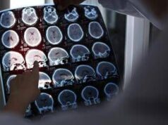 Nuove molecole e bersagli, così si evolve la terapia contro l’Alzheimer: il punto