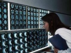 Radiologi Sirm: “Attenzione a medicina difensiva ed esami inappropriati”