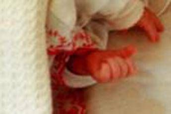 Torino, neonata salvata da rara malformazione al fegato con colla istantanea