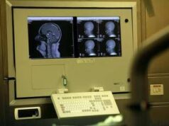 Medicina: Congresso Sin, neurologia tra innovazione, responsabilità e nuova organizzazione