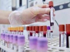 Tumori, cancro vescica: 70% pazienti libero da malattia a 2 anni con terapie perioperatorie