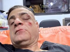 Cicalone, lo youtuber aggredito in metro a Roma: “Infami veri”