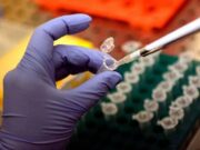 Focolaio di Legionella a Milano: 1 morto e 11 casi in zona San Siro: in corso le indagini di Ats