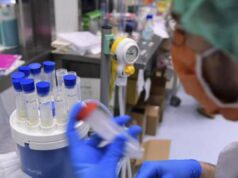 Legionella, a Milano sospetto focolaio: 11 casi con 1 morto in zona San Siro