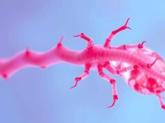 Miastenia, in Sardegna su mille pazienti stimati solo metà nel registro