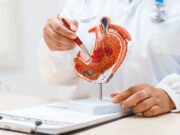 Tumore allo stomaco, pazienti: “Diagnosi precoce per meno di 1 su 5, migliorare percorsi”