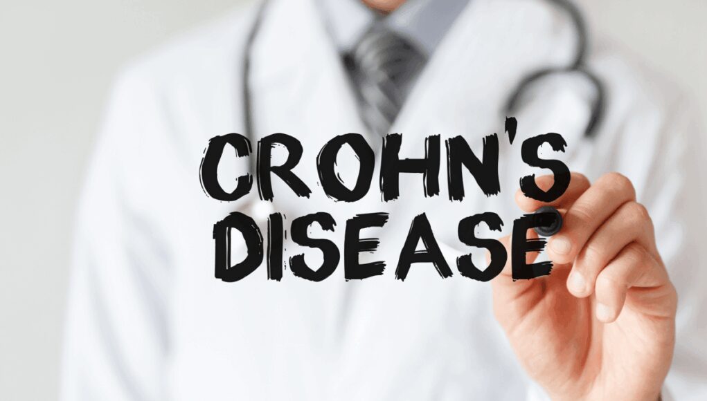 Medicina: malattia di Crohn, nutrizione clinica in corsi regionali Ig-Ibd per gastroenterologi