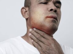 Angioedema ereditario, ok Ue a prima terapia preventiva mirata all’Rna