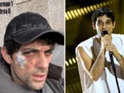 Bresh ferito al volto da un Dobermann, come sta il cantante