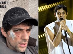 Bresh ferito al volto da un Dobermann, come sta il cantante