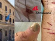 Denunciò botte e sequestro in cella: “Ora vivo nella paura, colpisce il silenzio delle istituzioni”