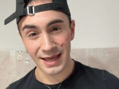 Genova, 19enne denuncia aggressione omofoba: “Sfregiato al viso con coltellino”