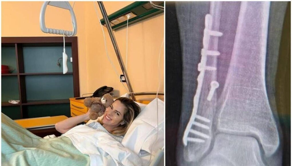 Thais Wiggers, operazione alla caviglia dopo incidente: “Comincio anno con un piede bionico”