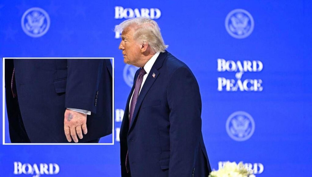 Trump, nuovo grande livido sul dorso della mano sinistra: il dettaglio non passa inosservato