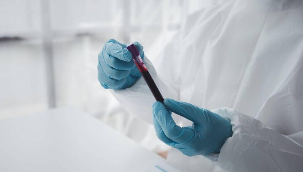 Epatite A in forte crescita in Italia: Lazio, Campania e Puglia le regioni con più casi