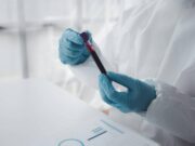 Epatite A in forte crescita in Italia: Lazio, Campania e Puglia le regioni con più casi